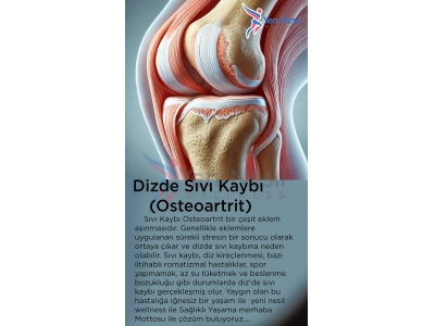 Dizde Sıvı Kaybı (Osteoartrit)