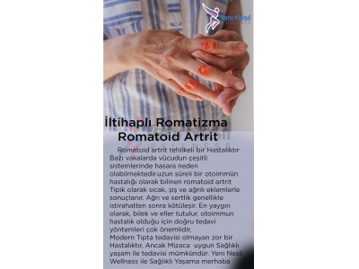 İltihaplı Romatizma (Romatoid Artrit)