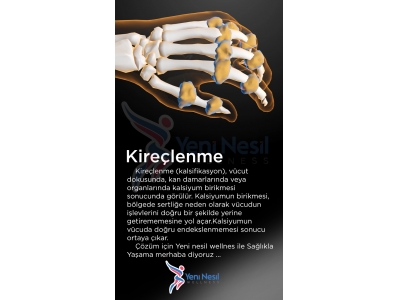 Kireçlenme