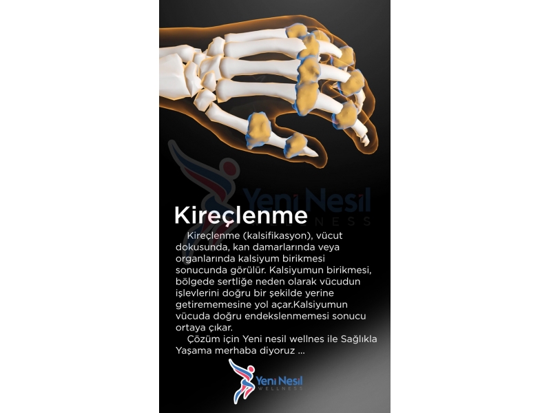 Kireçlenme